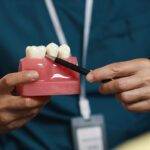 Implantes Dentários: A Solução Definitiva para Recuperar Seu Sorriso