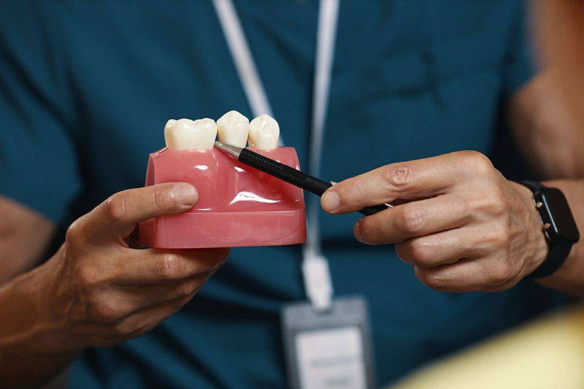Implantes Dentários: A Solução Definitiva para Recuperar Seu Sorriso